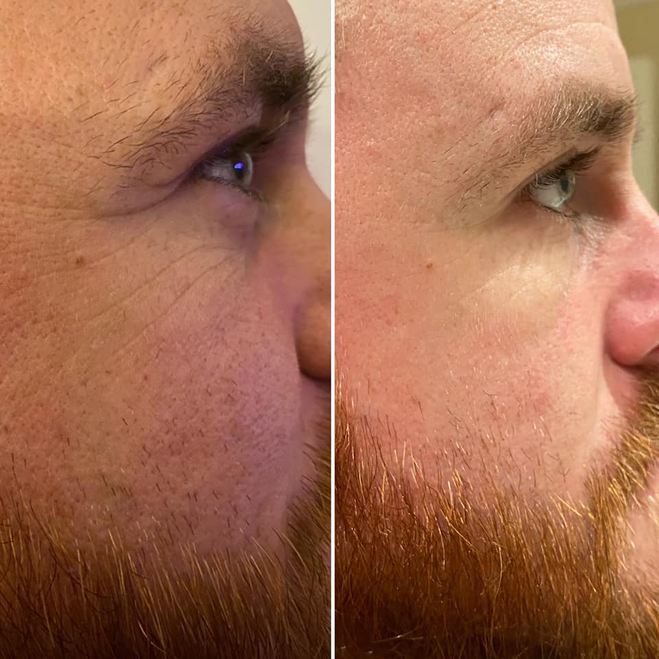 
                  
                    Load image into Gallery viewer, NEW Herbalife Collagen Skin Booster
                  
                